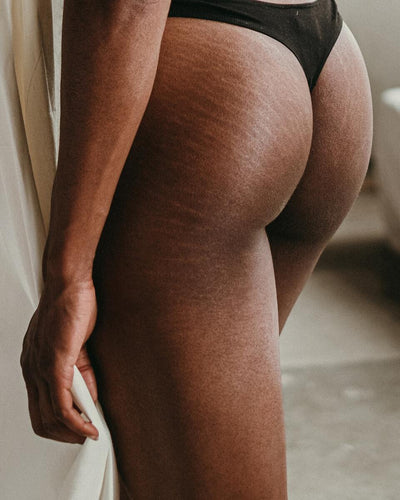 Which serum is best for stretch marks?